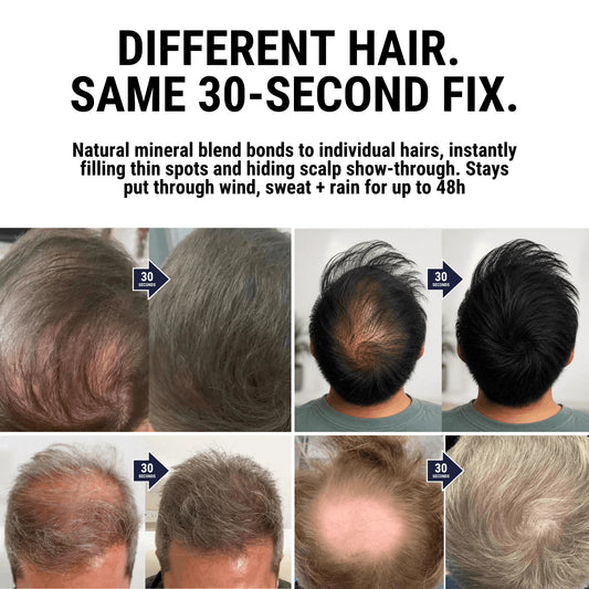Hair Density Filler-Powder Instant Hair Root Touch Up, Hair Topper for Women and Men